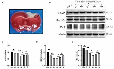 Diprotin A TFA Exerts Neurovascular Protection in Ischemic Cerebral Stroke